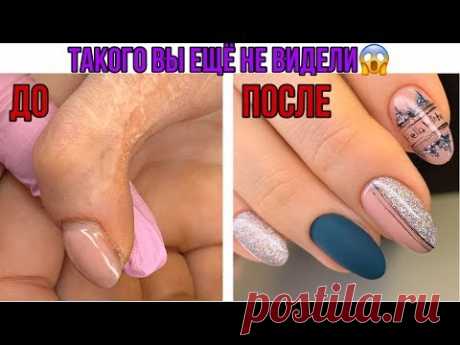Такого вы еще не видели😱ТРЕШ😱Работа с травмированным ногтем💅Простой дизайн ногтей - YouTube