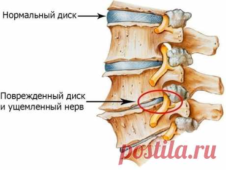 Чтобы поясница не болела !