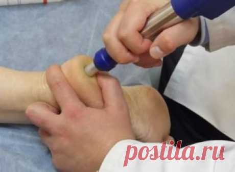 ШПОРУ ВЫЛЕЧИЛА ЗА 3 ДНЯ

Поделюсь рецептами от пяточных шпор. Прошлым летом на юге после ванн у меня так разболелась нога, что я не знала, куда ее деть. Пятка горела огнем. Приехав домой, побежала к хирургу. Молодая врач сделала снимок и объявила, что у меня после ванн обострилась пяточная шпора. Дала мне какую-то «памятку» - и все. Я поняла, что надо самой лечиться. Обратилась к народной медицине - стала искать рецепты от шпор. Все, что нашла, выписала и посылаю вам. Ведь...