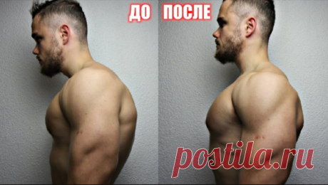 Техника исправления кифоза грудного отдела позвоночника