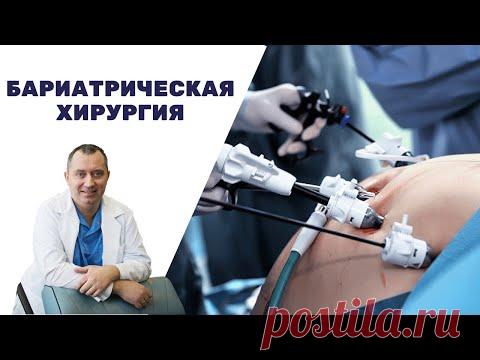Бариатрическая операция на желудке! Поможет похудеть?  Хирургический метод лечения ожирения.