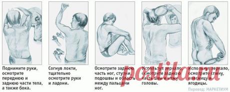 5 самых распространенных видов рака и их симптомы