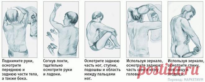 5 самых распространенных видов рака и их симптомы