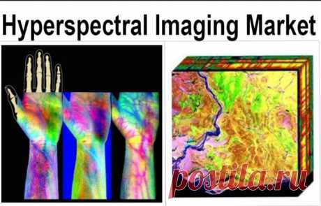 In 2022, the market size of medical hyperspectral imaging in the United States was valued at USD 483.6 million. It is expected to experience a compound annual growth rate (CAGR) of 13.4% during the forecast period.