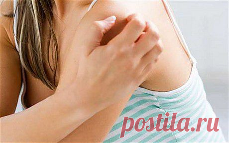 Мифы о чесотке |
Чесотка — кожное заболевание, которое вызывает чесоточный клещ. Обычно оно проявляется зудом, усиливающимся по ночам, и высыпаниями на коже.