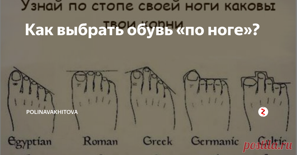 Как выбрать обувь «по ноге»? Прошли те времена, когда ради небольшой, аккуратной стопы женщины были готовы терпеть любую боль, нося узкие туфли на каблуках. Сейчас во главу угла ставится комфорт и здоровье, и все больше женщин отказываются от каблуков и узких туфель в пользу кроссовок, ботинок и прочей обуви на плоском ходу.
Такое состояние стоп после ношения обувь не нормально!
Более того, мода на биохакинг приводит к тому,