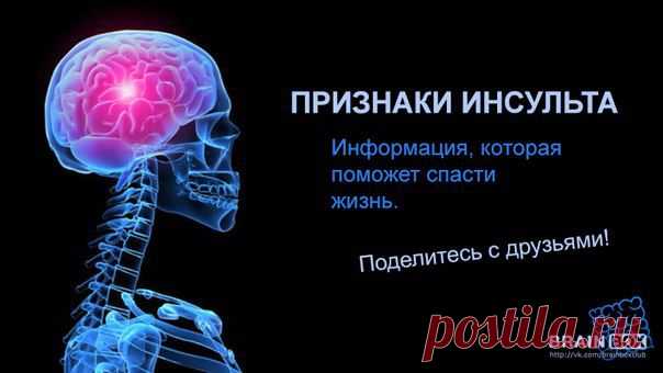 Четыре признака инсульта. Это нужно знать всем! | ЖЕНСКИЙ МИР