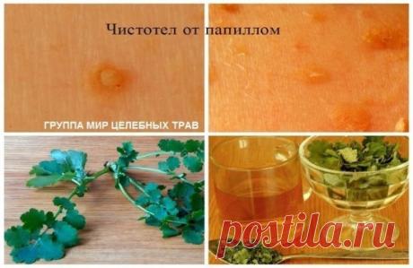 Средства и травы при вирусе папилломы - эффективные рецепты.
Папиллома является инфекционной болезнью, возбудитель которой - ВПЧ (вирус папилломы человека). Хотя это заболевание определено официальной медициной как доброкачественное новообразование, и в большинстве случаев не грозит человеку серьезными последствиями, лечить его все-таки нужно. Существует около сотни разновидностей этого вируса, и избавиться от этого недуга в домашних условиях не так уж и сложно.
1. Сок чистотела.
Чистотел счи