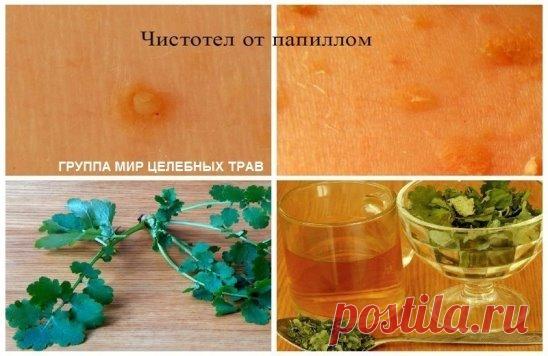 Средства и травы при вирусе папилломы - эффективные рецепты.
Папиллома является инфекционной болезнью, возбудитель которой - ВПЧ (вирус папилломы человека). Хотя это заболевание определено официальной медициной как доброкачественное новообразование, и в большинстве случаев не грозит человеку серьезными последствиями, лечить его все-таки нужно. Существует около сотни разновидностей этого вируса, и избавиться от этого недуга в домашних условиях не так уж и сложно.
1. Сок чистотела.
Чистотел счи