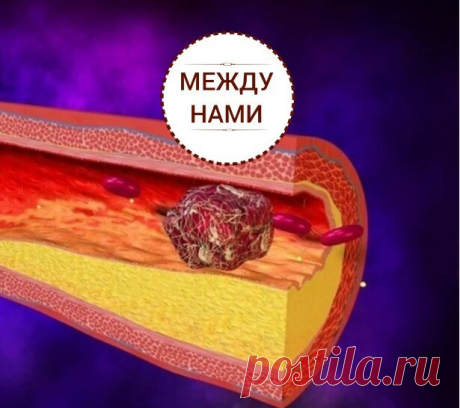 Какие напитки способствуют рассасыванию тромбов? (часть 2) | Между нами | Яндекс Дзен