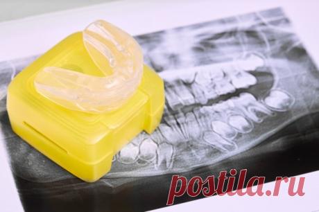 Смени пластинку. Ортодонт рассказала, как исправить прикус и неровные зубы. Если вы все еще думаете, что исправить неровные зубы можно с помощью пластинок, или, в крайнем случае, брекетов, это значит, что вы безнадежно отстали от жизни.