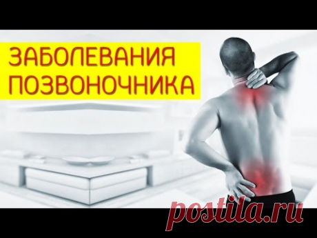 Заболевания позвоночника. Лишний вес позвоночник. [Галина Гроссманн]