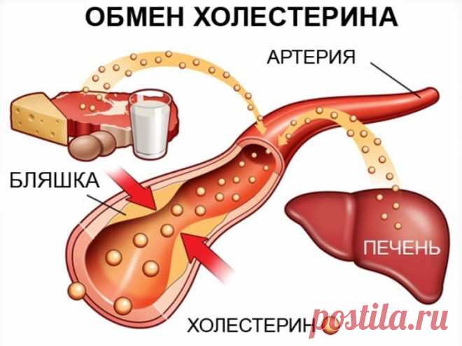 До свидания холестерин, глюкоза в крови, липиды и триглицериды! — Домашние заботы