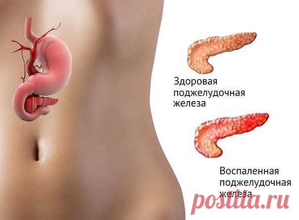 ЕСЛИ БЕСПОКОИТ ПОДЖЕЛУДОЧНАЯ ЖЕЛЕЗА   /  семя льна. /