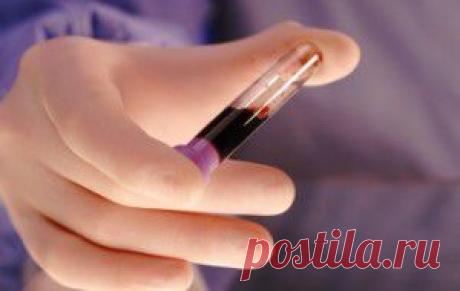 Очищение крови | vita-jizn.net
Очищение крови имеет большое значение. Учитывая количество потребляемых нами медикаментов и экологическую обстановку очищение крови необходимо почти каждому.
12 рецептов очищения крови!