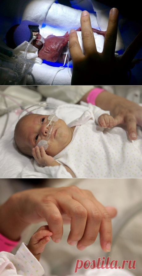 Девочка размером с ладонь встретит Рождество дома • НОВОСТИ В ФОТОГРАФИЯХ