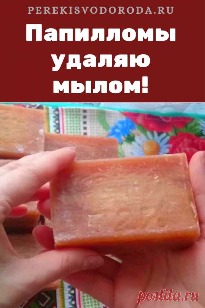 Папилломы удаляю мылом: вот как я это делаю Как убрать папилломы с кожи — это я и сама знаю. Причем, никто еще не сказал что не удалось.Значится так: берешь кусок хозяйственного мыла 72%. И натираешь пораженное место. Без особого остервенения, просто чтоб смазать. Хочешь — сухим мылом мокрую кожу. Хочешь — мокрым мылом сухую кожу. Без разницы. Обычно так делают на ночь (почему-то ...
