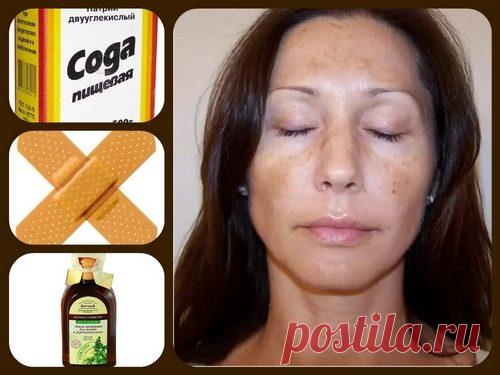 Народное средство от пигментных пятен