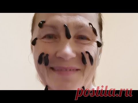 Пиявки На Лицо