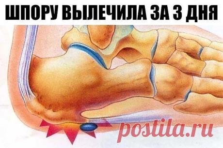 ШПОРУ ВЫЛЕЧИЛА ЗА 3 ДНЯ