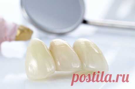 ​Протезирование зубов в СВАО - Dentolux