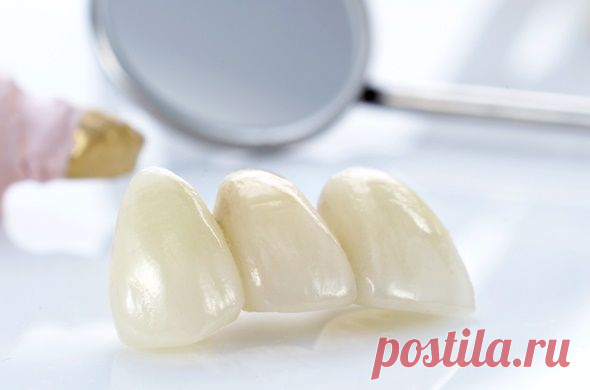 ​Протезирование зубов в СВАО - Dentolux