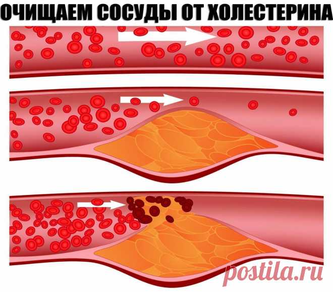 (1) Одноклассники