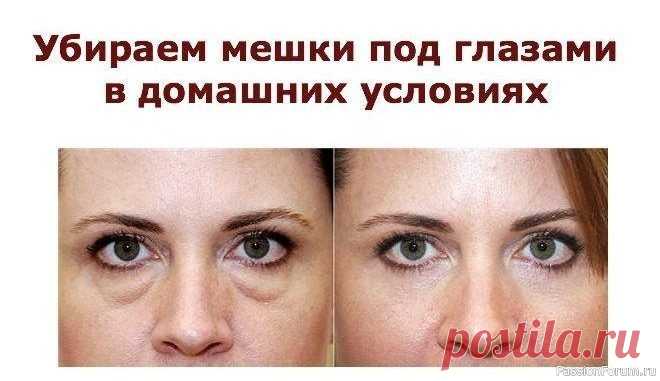 Как убрать мешки под глазами и быстро снять отеки Устранение мешков под глазами может быть достигнуто различными способами, в зависимости от причины их появления.ТОП — 9 полезных рекомендаций:1. **Сон и отдых**: Убедитесь, что вы получаете достаточное количество сна. Недостаток сна может усугубить проблему.2. **Гидратация**: Пейте...