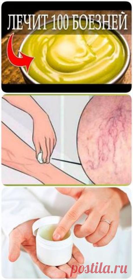 «Золотая мазь» — лечит 100 болезней, делается очень просто. С этим рецептом о врачах точно забудете!
