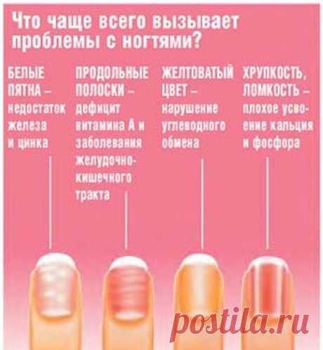 белые пятна на ногтях пальцев рук причина у женщин: 11 тыс изображений найдено в Яндекс.Картинках