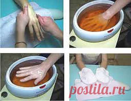 Парафинотерапия | МОЛОДОСТЬ В ТВОИХ РУКАХ