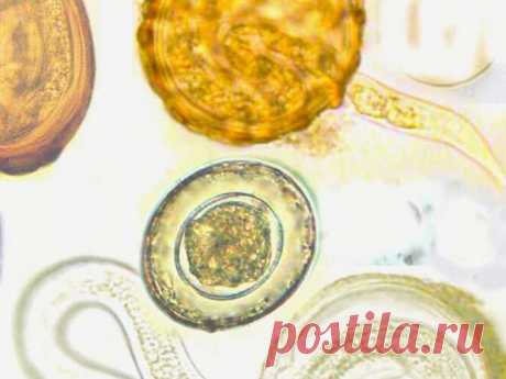 Признаки наличия паразитов в организме. Проверьте себя и своих близких! — СОВЕТНИК