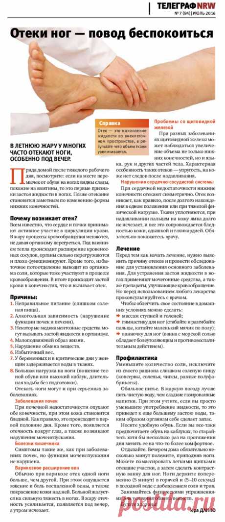 Отеки ног - повод беспокоиться