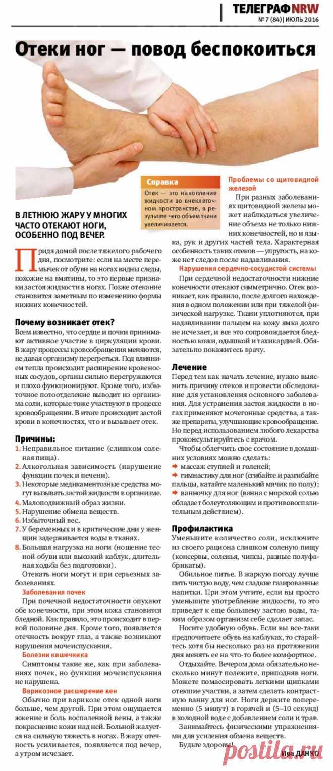 Отеки ног - повод беспокоиться