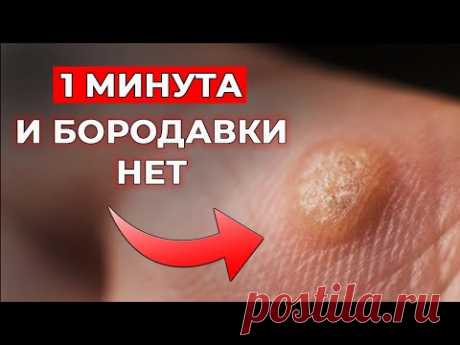 Всего один продукт - и папилломы исчезнут навсегда! / Народное средство от папиллом