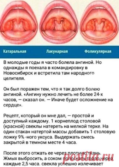 Избавляемся от ангины