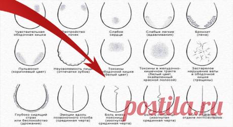 Как по языку узнать о сбоях в работе позвоночника, желудка, печени и предотвратить их?