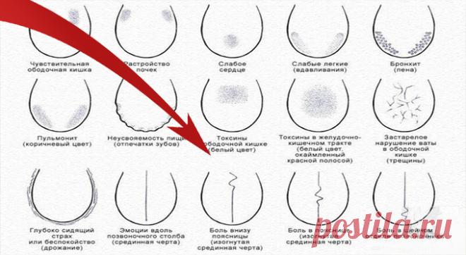 Как по языку узнать о сбоях в работе позвоночника, желудка, печени и предотвратить их?