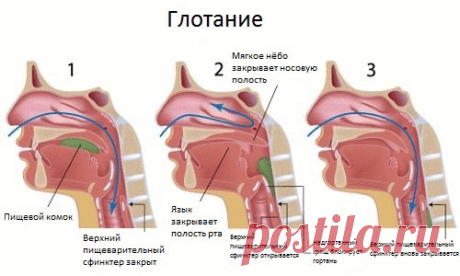 Первая помощь если что-то застряло в горле — прием Геймлиха