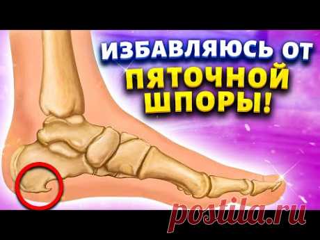 Делаю это на ночь и забыла о пяточной шпоре. Плантарный фасциит. Больные ноги превращает в здоровые.
