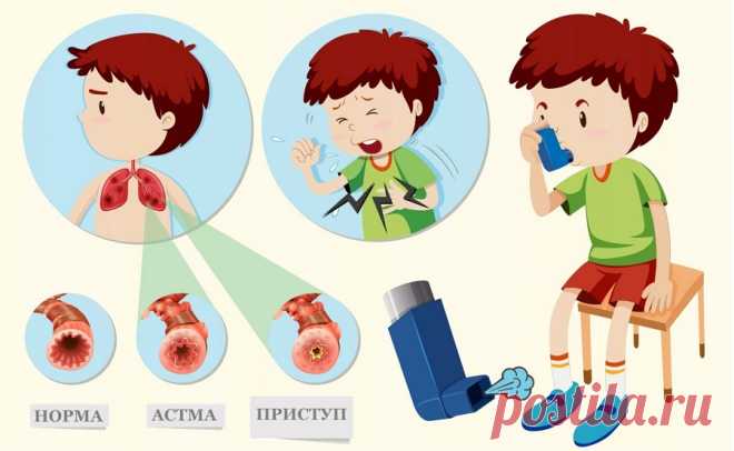 Лекарства для астматиков