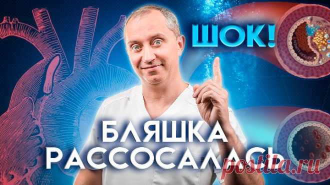 Это важно знать об атеросклерозе! Как 