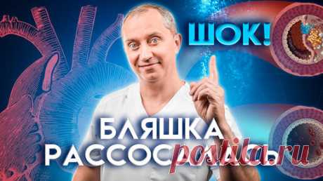 Всё, что важно знать об атеросклерозе. Как "почистить" сосуды от атеросклеротических бляшек? | Блог Доктора Шишонина | Дзен