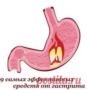 9 самых эффективных средств от гастрита. Лечить