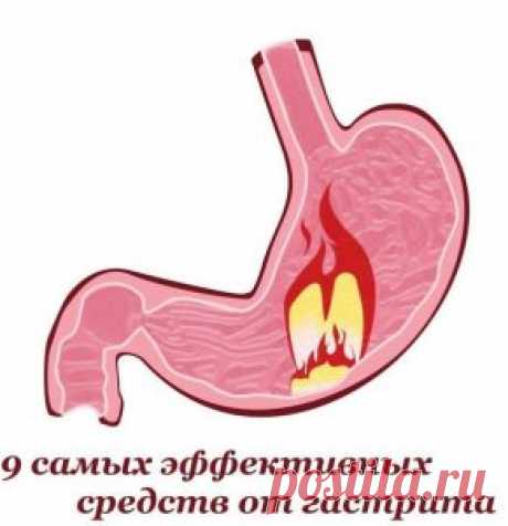 9 самых эффективных средств от гастрита. Лечить