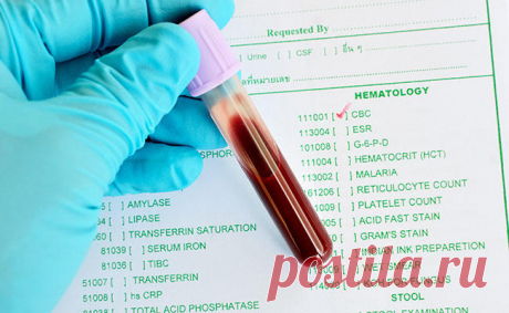 Новости - МирТесен