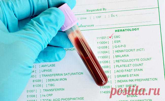 Новости - МирТесен