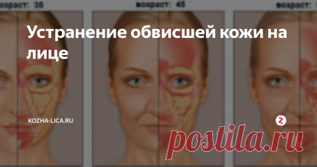 Устранение обвисшей кожи на лице Причины и симптомы обвисания кожи
Когда  человек поправляется, первым полнеет лицо. В области щек, между  лицевыми мышцами, расположены мешочки, в которых образуется жировая  ткань. Убрать ее очень сложно. После похудения растянутая кожа лица под  тяжестью мешочков провисает, и появляются обвисшие щеки. Этот же эффект  наблюдается и с возрастом. Выработка коллагена уменьшается, кожа  становится ме