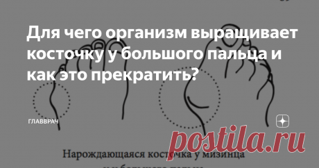 Для чего организм выращивает косточку у большого пальца и как это прекратить? Косточка у большого пальца (hallux valgus) - это компенсатор. Косточку выращивает сам организм. Для чего организм выращивает косточку, и как он это делает?
Для нормальной работы опорно-двигательного аппарата необходима полная стопа. Инженерия стопы в том, чтобы соединяться с поверхностью земли не только через зоны плотности, такие как пятка, подушечки пальцев и подушечки под пальцами, а и через