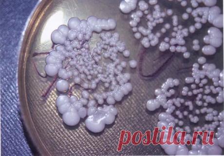 МОЛОЧНИЦА: факты о заболевании, которые нужно знать